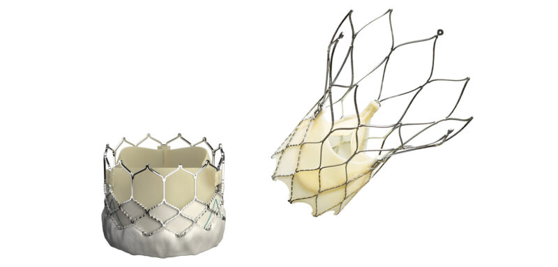 EU TAVI Market 2026: Growth, Competition, and the Rise of New Challengers